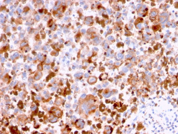 Anti-CD63 (Late Endosomes Marker), clone LAMP3/2788