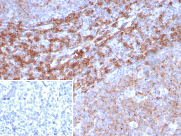 Anti-CD39 / ENTPD1 (Marker of Tumor-specific T cells), recombinant antibody, clone CD39/8162R