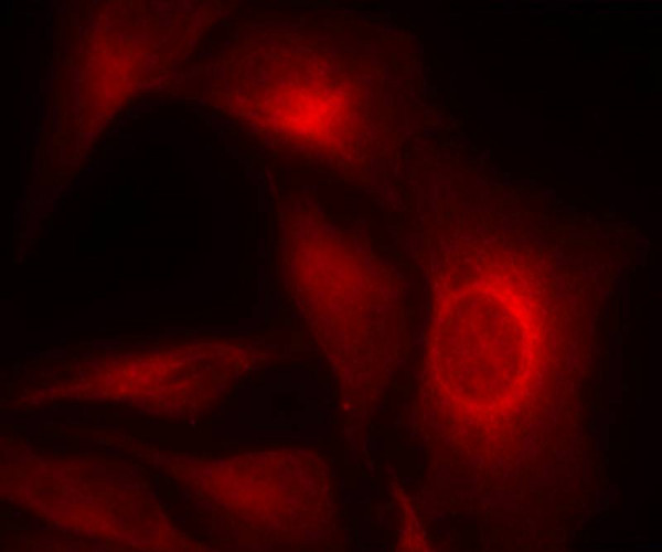Anti-phospho-HSP27 (Ser15)