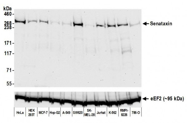 Anti-Senataxin Recombinant Monoclonal