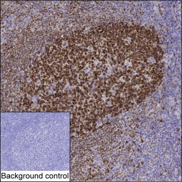 Anti-IRAG2