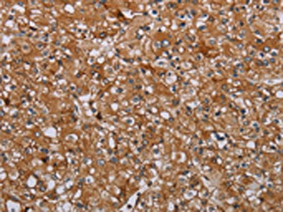 Anti-ATP2A1