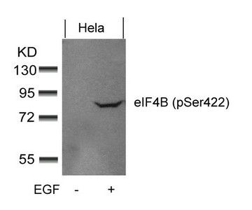 Anti-Phospho-EIF4B (Ser422)