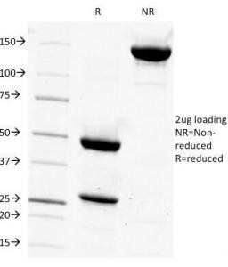Anti-CD14 (Monocyte and Macrophage Marker), clone LPSR/927