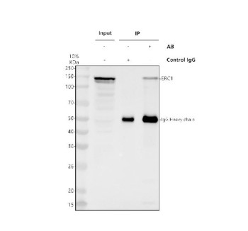 Anti-ERC1 / ELKS/RAB6-interacting/CAST family member 1