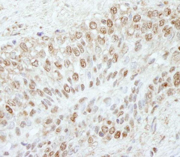 Anti-WDR91 (IHC)