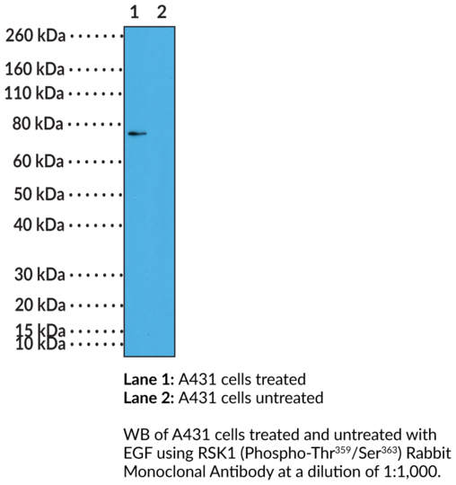 Anti-RSK1 (Phospho-Thr359/Ser363) Rabbit Monoclonal Antibody (Clone RM233)