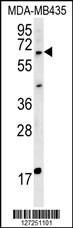 Anti-MKRN3, ID (MKRN3, D15S9, RNF63, ZNF127, Probable E3 ubiquitin-protein ligase makorin-3, RING fi