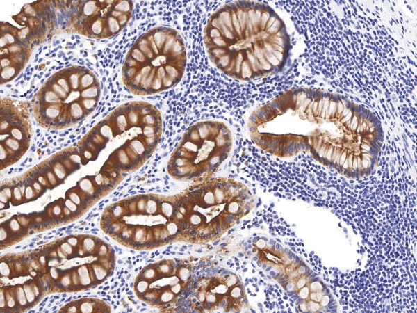 Anti-CEA Monoclonal Antibody (Clone:IHC543)-Ready to Use