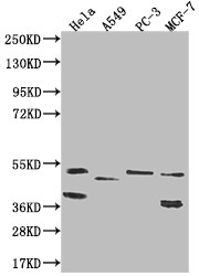 Anti-PLEKHA1 Recombinant Monoclonal, clone 16C9