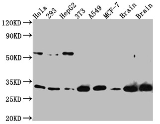 Anti-PGAM1 Recombinant Monoclonal, clone 9A5