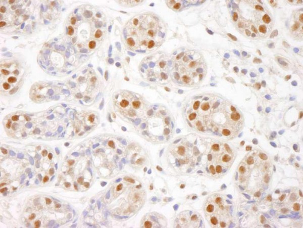 Anti-SMC1 (IHC)