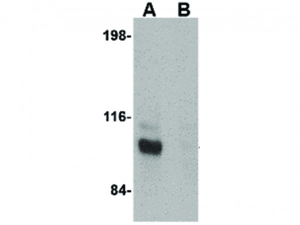 Anti-JPH3