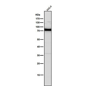 Anti-PKC / Protein kinase C, clone 31P91