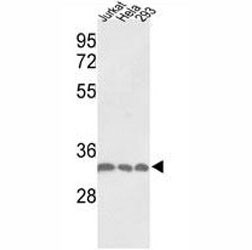 Anti-PCNA