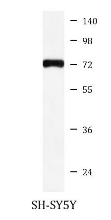 Anti-BACE1