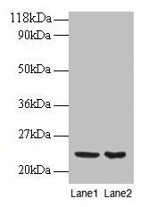 Anti-PRDX1