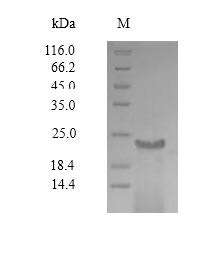 Envelope glycoprotein (GP), partial, Sudan ebolavirus, recombinant