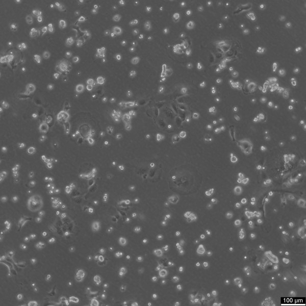 Hep-64.1 Cells