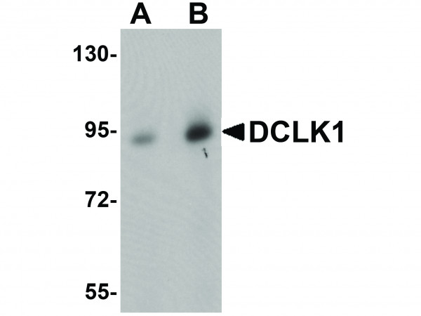 Anti-DCLK1