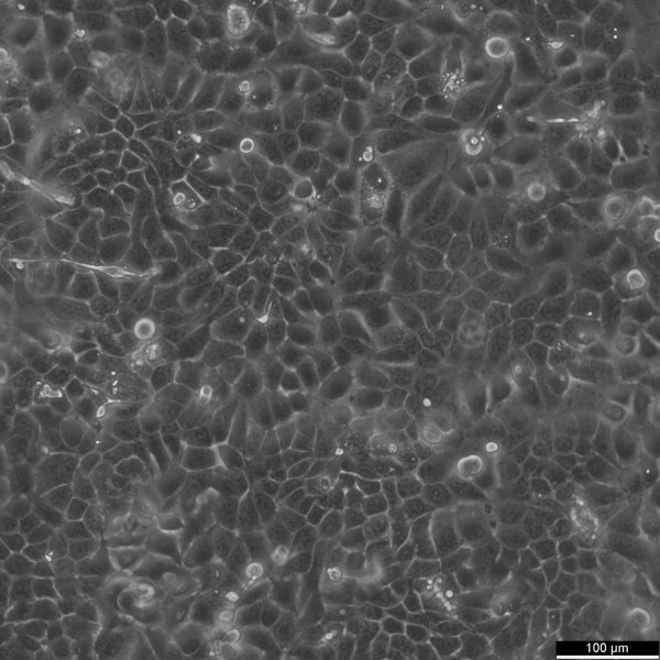 RT-112 Cells