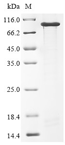 Neural cell adhesion molecule 1 (Ncam1), partial, mouse, recombinant