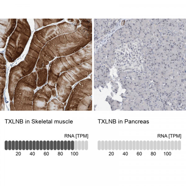 Anti-TXLNB