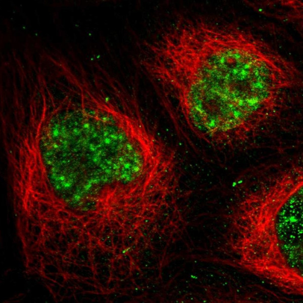 Anti-MPP1