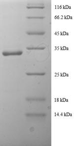 Tricarboxylate transport protein (SLC20A3), partial, human, recombinant