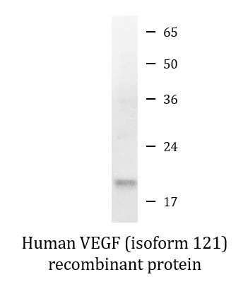 Human VEGF121 recombinant protein (Active)