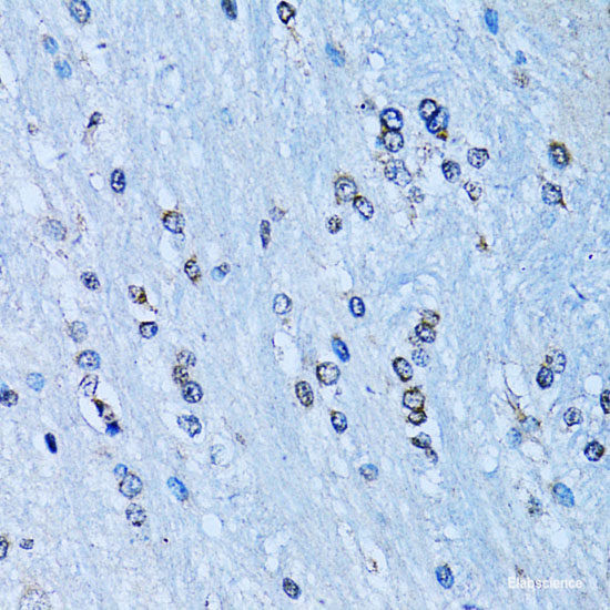 Anti-NF-kappaB-p100