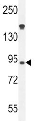 Anti-Myeloperoxidase
