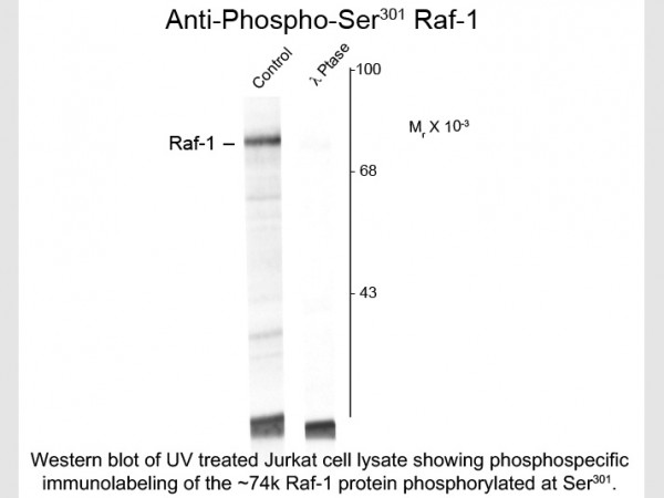 Anti-phospho-Raf-1 (Ser301)