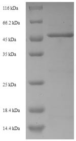 Tumor necrosis factor receptor superfamily member 21 (TNFRSF21), partial, human, recombinant