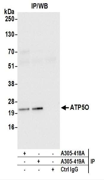Anti-ATP5O