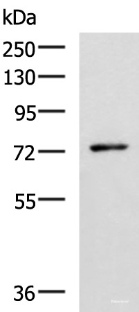 Anti-L3MBTL2