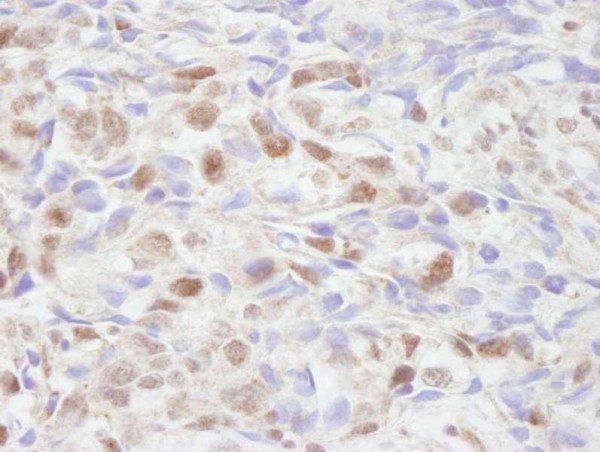 Anti-NCOA2/SRC2 (IHC)