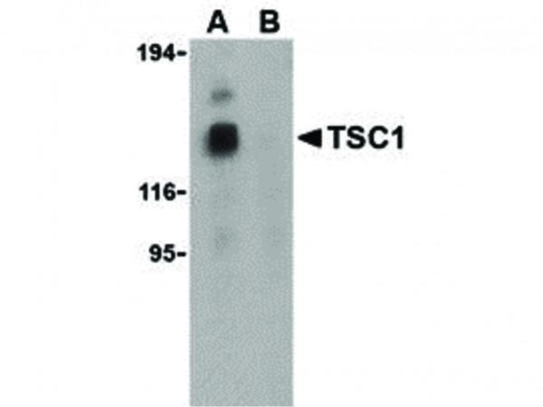 Anti-TSC1