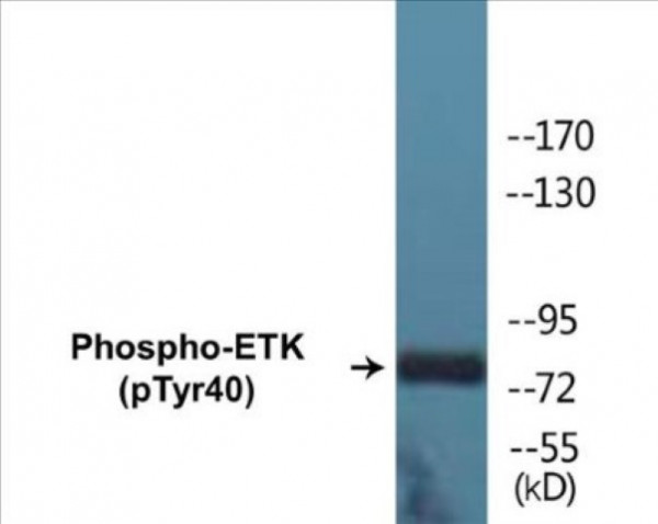ETK (Phospho-Tyr40) Colorimetric Cell-Based ELISA Kit