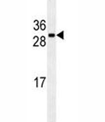 Anti-CDCA8, clone 181CT41.2.3
