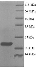 Plexin-A1 (PLXNA1), partial, human, recombinant