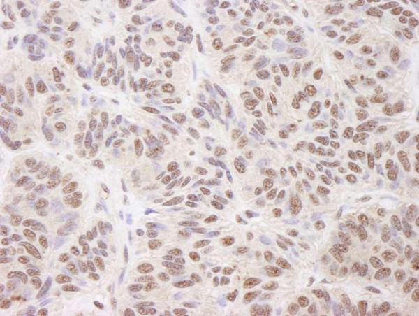 Anti-BTF (IHC)