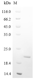 Hemagglutinin-neuraminidase (HN), partial, human parainfluenza 1 virus, recombinant