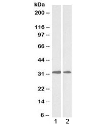 Anti-LOX / Lysyl Oxidase