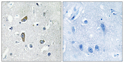 Anti-CDK5 Activator-binding C48