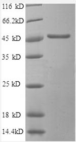 Secretory carrier-associated membrane protein 3 (SCAMP3), partial, human, recombinant