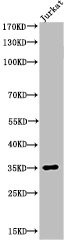 Anti-Acetyl-APEX1 (K7)