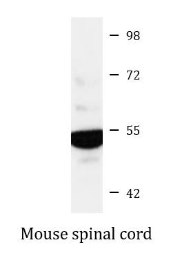 Anti-Glycine Receptor alpha 2