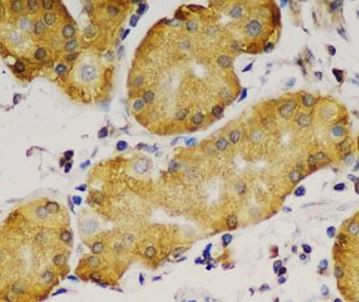 Anti-IGF2BP3