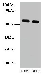Anti-PHGDH